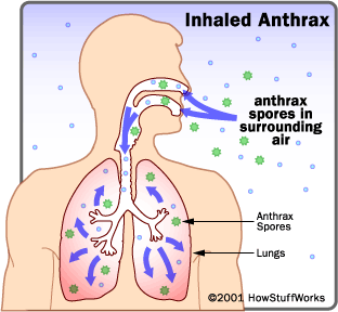The Symptoms - Anthrax. A Contagious Disease